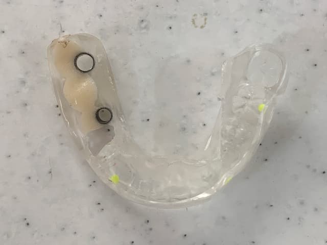 サージカルガイド